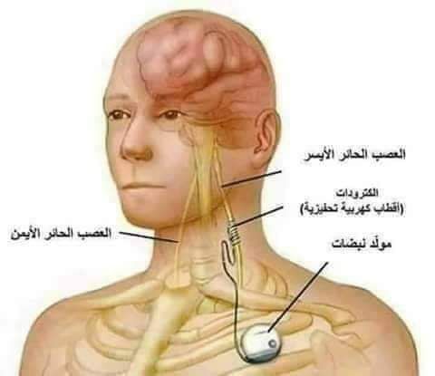 العصب الحائر _القلب